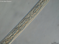 zvrásněná kutikula infekční larvy hlístice