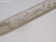 vajíčka v reprodukční soustavě samice Ashworthius sidemi (zubr evropský)