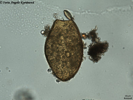 vajíčko Fascioloides magna (materiál poskytnut PřF UK)