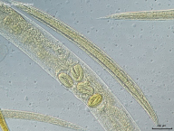 reprodukkční soustava samice saprofytické hlístice