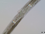 Teladorsagia circumcincta, samice, vyústění reprodukční soustavy