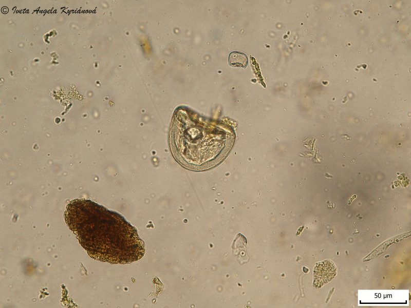 Parazitákból származó rókagomba infúziója - Helmint és immunválasz